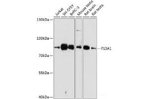 Western blot analysis of extracts of various cell lines using F13A1 Polyclonal Antibody at dilution of 1:3000. (F13A1 antibody)