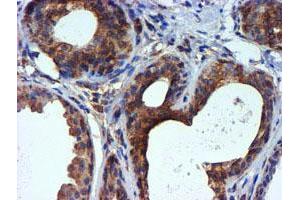 Immunohistochemical staining of paraffin-embedded Human breast tissue using anti-TUBAL3 mouse monoclonal antibody. (TUBAL3 antibody  (AA 150-446))