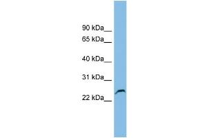 WB Suggested Anti-GSTK1 Antibody Titration: 0. (GSTK1 antibody  (Middle Region))