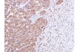 IHC-P Image Immunohistochemical analysis of paraffin-embedded NCIN87 xenograft, using STK25, antibody at 1:100 dilution. (STK25 antibody)