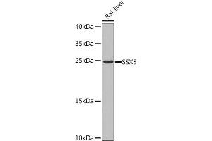 Western blot analysis of extracts of Rat liver, using SSX5 Rabbit pAb  at 1:1000 dilution.