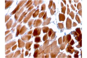 Formalin-fixed, paraffin-embedded human Cardiac Muscle stained with Sarcomeric Actinin Alpha 2 Mouse Monoclonal Antibody (ACTN2/3292). (ACTN2 antibody  (AA 557-692))