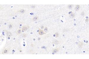Detection of Cys-C in Porcine Cerebrum Tissue using Polyclonal Antibody to Cystatin C (Cys-C) (CST3 antibody  (AA 42-127))