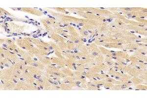 Detection of DBI in Mouse Cardiac Muscle Tissue using Polyclonal Antibody to Diazepam Binding Inhibitor (DBI) (Diazepam Binding Inhibitor antibody  (AA 2-87))