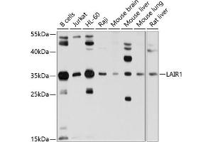 Western blot analysis of extracts of various cell lines, using L antibody (ABIN6131546, ABIN6143063, ABIN6143064 and ABIN6214255) at 1:1000 dilution. (LAIR1 antibody)