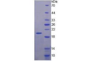 SDS-PAGE analysis of Human NAGase Protein. (MGEA5 Protein)