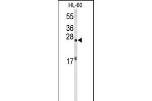 Western blot analysis of EIF4E Antibody (ABIN650675 and ABIN2838634) in HL-60 cell line lysates (35 μg/lane). (EIF4E antibody)