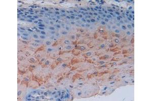 #VALUE! (SCEL antibody  (AA 519-685))