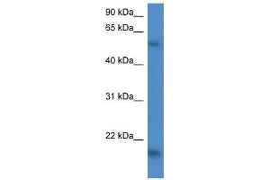 Human HepG2; WB Suggested Anti-GPT2 Antibody Titration: 0.