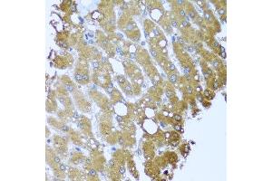 Immunohistochemistry of paraffin-embedded human liver injury using STRN antibody at dilution of 1:100 (x40 lens). (Striatin antibody)