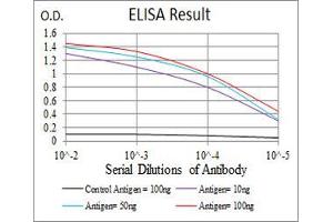 Black line: Control Antigen (100 ng), Purple line: Antigen(10 ng), Blue line: Antigen (50 ng), Red line: Antigen (100 ng), (Ezrin antibody  (AA 292-464))