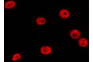 ABIN6278578 staining MCF7 by IF/ICC. (HES6 antibody  (N-Term))