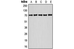 Western blot analysis of ATF2 (pS498) expression in HeLa UV-treated (A), Jurkat (B), NIH3T3 (C), SP2/0 UV-treated (D), MCF7 UV-treated (E) whole cell lysates. (ATF2 antibody  (C-Term, pSer498))
