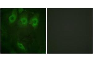 Immunofluorescence analysis of HeLa cells, using EGFR (Phospho-Tyr1016) Antibody.