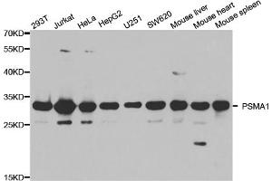Western blot analysis of extracts of various cell lines, using PSMA1 antibody (ABIN5971354) at 1/1000 dilution.