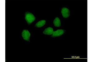 Immunofluorescence of purified MaxPab antibody to SOX6 on HeLa cell. (SOX6 antibody  (AA 1-828))