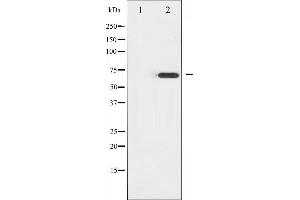 Western blot analysis of ZAP-70 expression in Jurkat whole cell lysates,The lane on the left is treated with the antigen-specific peptide. (ZAP70 antibody  (Internal Region))