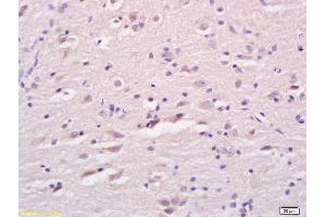 Formalin-fixed and paraffin embedded rat brain labeled with Anti LCAT Polyclonal Antibody, Unconjugated (ABIN676118) at 1:200 followed by conjugation to the secondary antibody and DAB staining (LCAT antibody  (AA 151-250))