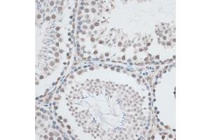 Immunohistochemistry of paraffin-embedded mouse testis using AQR antibody (ABIN6133411, ABIN6137057, ABIN6137058 and ABIN6221662) at dilution of 1:100 (40x lens). (AQR antibody  (AA 400-700))