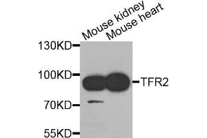 Western blot analysis of extracts of mouse kidney and mouse heart cells, using TFR2 antibody. (Transferrin Receptor 2 antibody)