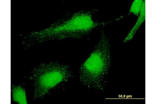 PCGF6 antibody  (AA 225-324)