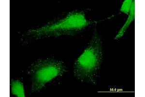 Immunofluorescence of monoclonal antibody to PCGF6 on HeLa cell. (PCGF6 antibody  (AA 225-324))
