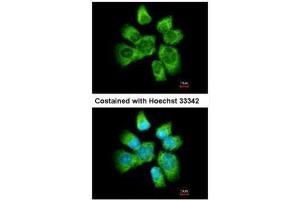 ICC/IF Image Immunofluorescence analysis of methanol-fixed A431, using AHA-1, antibody at 1:500 dilution. (AHSA1 antibody  (Center))