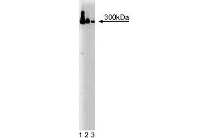 Western blot analysis of IP3R-3 on a HeLa cell lysate. (ITPR3 antibody  (AA 22-230))