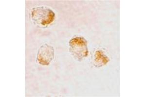 Immunocytochemistry staining of HL-60 cells using BAX polyclonal antibody  at 2 ug/mL . (BAX antibody  (N-Term))