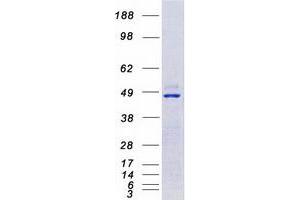 Western Blotting (WB) image for Calcium/calmodulin-Dependent Protein Kinase IV (CAMK4) protein (Myc-DYKDDDDK Tag) (ABIN2713095)