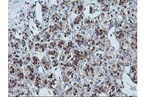 Image no. 2 for anti-Ubiquitin-Conjugating Enzyme E2G 2 (UBE2G2) antibody (ABIN1501630) (UBE2G2 antibody)