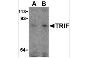 Western Blotting (WB) image for anti-Toll-Like Receptor Adaptor Molecule 1 (TICAM1) (C-Term) antibody (ABIN1030771) (TICAM1 antibody  (C-Term))