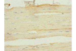 Immunohistochemistry of paraffin-embedded human skeletal muscle tissue using ABIN7153138 at dilution of 1:100 (FHL3 antibody  (AA 1-280))