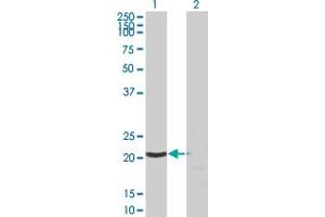Western Blot analysis of SSSCA1 expression in transfected 293T cell line by SSSCA1 monoclonal antibody (M03), clone 2H4. (SSSCA1 antibody  (AA 1-199))