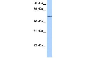 CRAT antibody used at 1 ug/ml to detect target protein. (CRAT antibody  (N-Term))