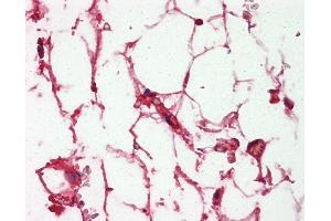 Anti-Complement C3/C3c antibody IHC of human adrenal, adipocytes. (Complement C3c antibody)