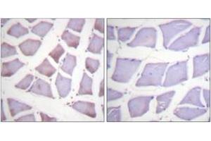 Immunohistochemistry analysis of paraffin-embedded human skeletal muscle tissue, using XIAP (Ab-87) Antibody. (Intestinal Alkaline Phosphatase antibody  (AA 53-102))