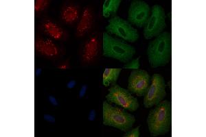 ABIN6257590 and ABIN6274935 staining  cells by IF/ICC. (CHP antibody  (Internal Region))
