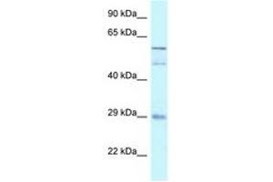 Image no. 1 for anti-GDNF Family Receptor alpha 4 (GFRA4) (AA 182-231) antibody (ABIN6747540) (GFRA4 antibody  (AA 182-231))