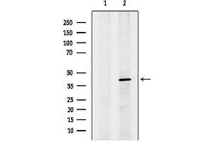 anti-G Protein-Coupled Estrogen Receptor 1 (GPER) (C-Term) antibody