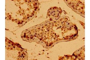 Immunohistochemistry of paraffin-embedded human testis tissue using ABIN7166328 at dilution of 1:100 (WWC2 antibody  (AA 828-1127))