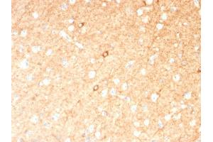 Formalin-fixed, paraffin-embedded human Brain stained with GAD1 (GAD67) Mouse Monoclonal Antibody (GAD1/2391). (GAD antibody  (AA 72-135))