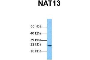 Host:  Rabbit  Target Name:  NAT13  Sample Tissue:  Human MCF7  Antibody Dilution:  1. (NAA50 antibody  (C-Term))