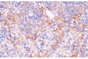 Immunohistochemistry of paraffin-embedded Rat spleen using NT5E / CD73 Polyclonal Antibody at dilution of 1:200 (40x lens). (CD73 antibody)