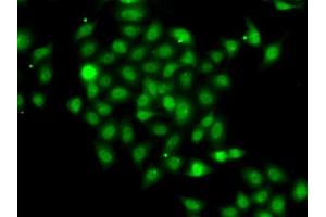 Immunofluorescence analysis of A-549 cells using COPS2 antibody (ABIN6130123, ABIN6138877, ABIN6138878 and ABIN6222819). (COPS2 antibody  (AA 1-310))