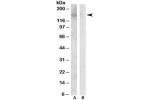 Western blot testing of Jurkat lysate with HER3 antibody at 0. (ERBB3 antibody)