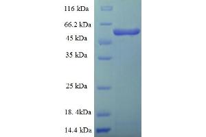 threonyl-tRNA Synthetase 2, Mitochondrial (TARS2) (AA 369-718), (partial) protein (His-SUMO Tag)