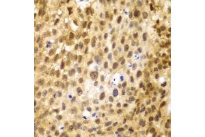 Immunohistochemistry (Paraffin-embedded Sections) (IHC (p)) image for anti-Interferon Regulatory Factor 3 (IRF3) (AA 1-260) antibody (ABIN6142528)