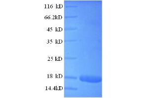 SDS-PAGE (SDS) image for Interferon, alpha 2 (IFNA2) (AA 24-188) protein (GST tag) (ABIN5711057) (IFNA2 Protein (AA 24-188) (GST tag))