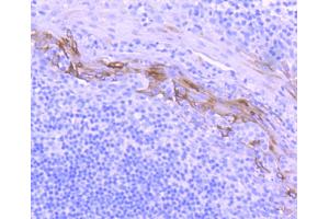Paraformaldehyde-fixed, paraffin embedded human tonsil, Antigen retrieval by boiling in sodium citrate buffer (pH6) for 15min, Block endogenous peroxidase by 3% hydrogen peroxide for 30 minutes, Blocking buffer at 37°C for 20min, Antibody incubation with Cytokeratin 10 (1D8) Monoclonal Antibody  at 1:50 overnight at 4°C, followed by a conjugated secondary and DAB staining. (Keratin 10 antibody)